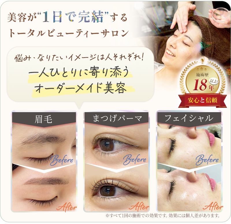 ビフォーアフター画像